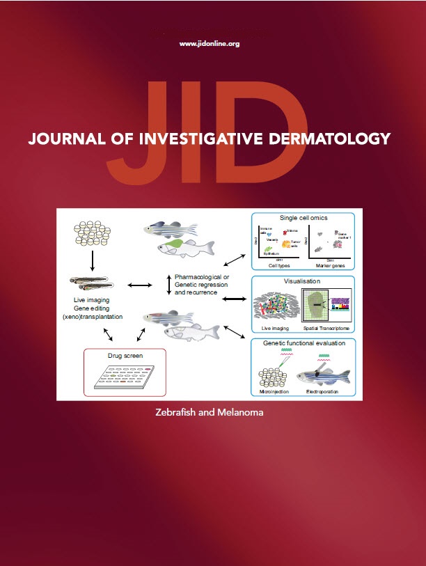 Journal Of Investigative Dermatology Jid Sid 7303